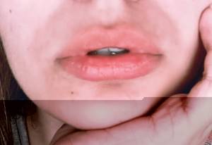 Negativeemortion420 profile