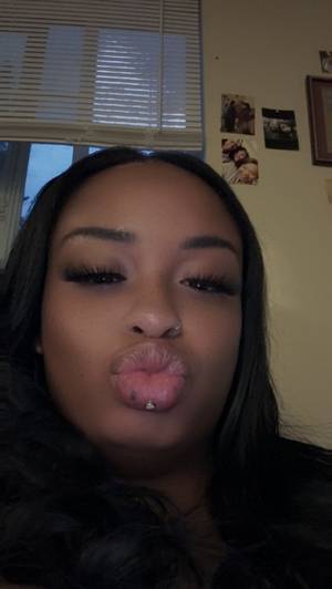 Serinastacxx profile